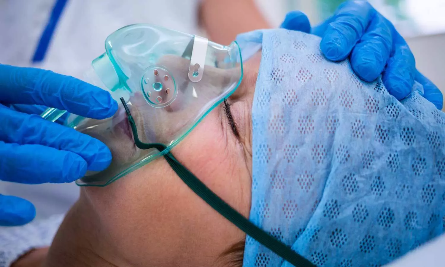 24-Hour Oxygen Therapy fails to Add Survival Benefit Over 15-Hour oxygen Therapy for Severe Hypoxemia: NEJM 24-Hour Oxygen Therapy fails to Add Survival Benefit Over 15-Hour oxygen Therapy for Severe Hypoxemia: NEJM