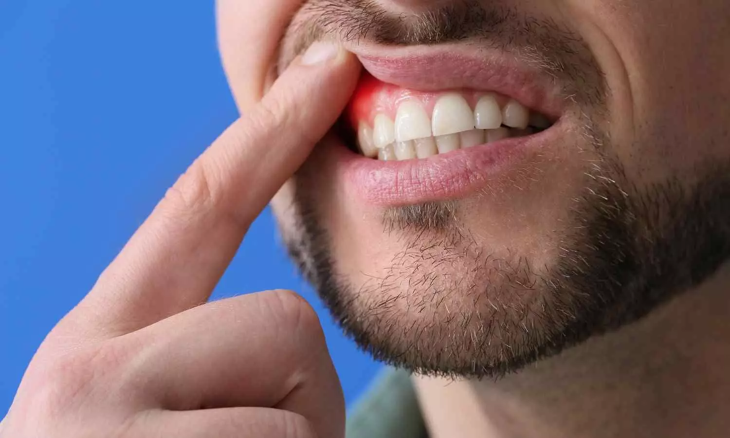 Protect your teeth with fruit: antimicrobial effects found in biomass compounds Protect your teeth with fruit: antimicrobial effects found in biomass compounds